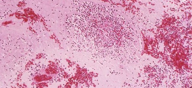 Michigan Reports Its First 2015 Case Of Bubonic Plague